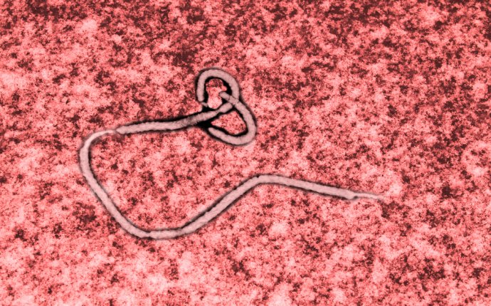 20 Things You Didn t Know About Viruses | DiscoverMagazine.com