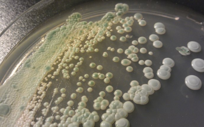 About the morphology of colonies | Eureka Brewing