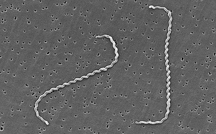 Leptospira - Wikipedia