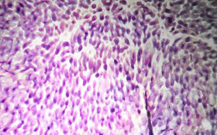 List of Good Bacteria | LIVESTRONG.COM
