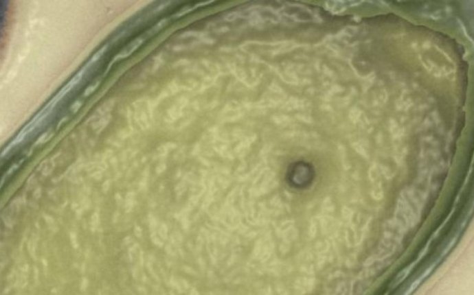 Meet the world s largest virus