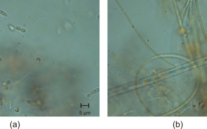 Microorganisms In Water Sample