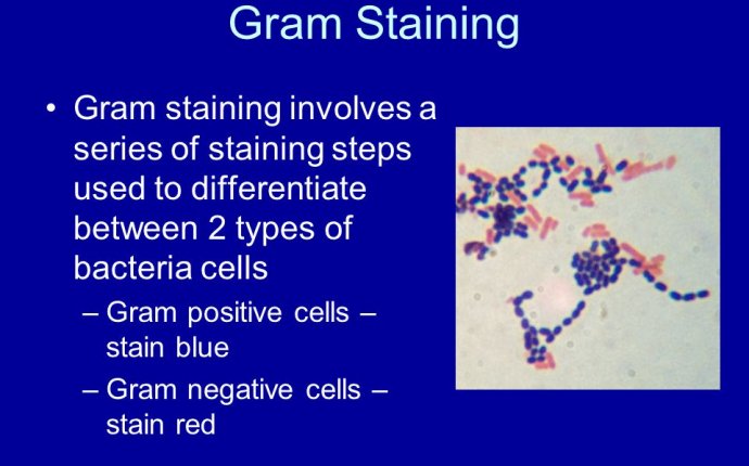 Plate 14 Staining Bacteria. - ppt download