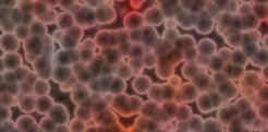 Gram Negative Bacteria Gram Negative Bacteria