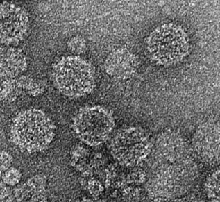 PdPV-pa virus