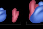 Ribosomes are made of one large and one small subunit. robosomes large small