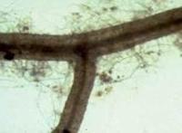 Root heavily infected with mycorrhizal fungi