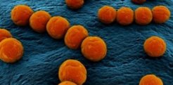 Shapes of Bacteria Shapes of Bacteria
