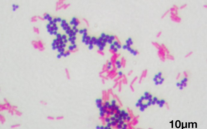 Salmonella Bacteria Diagram